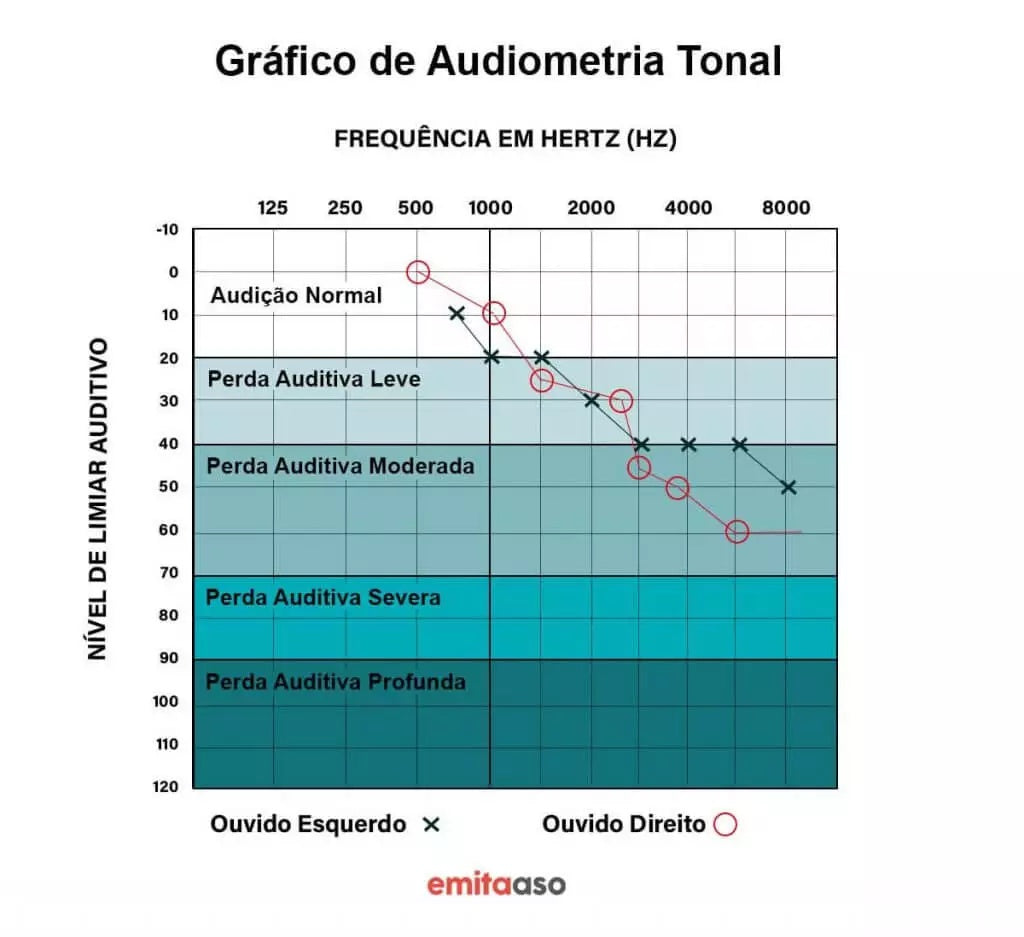 Gráfico de audiometria tonal